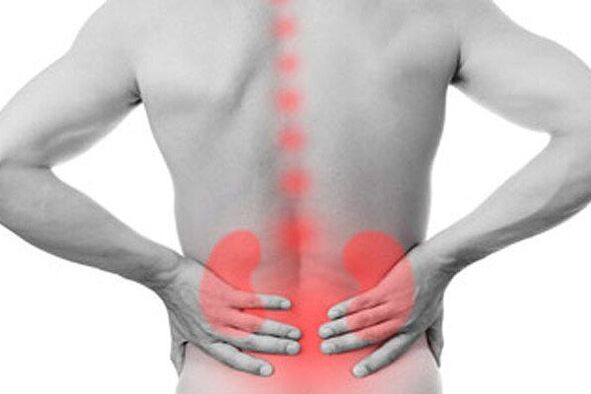 Kidney disease can cause back pain