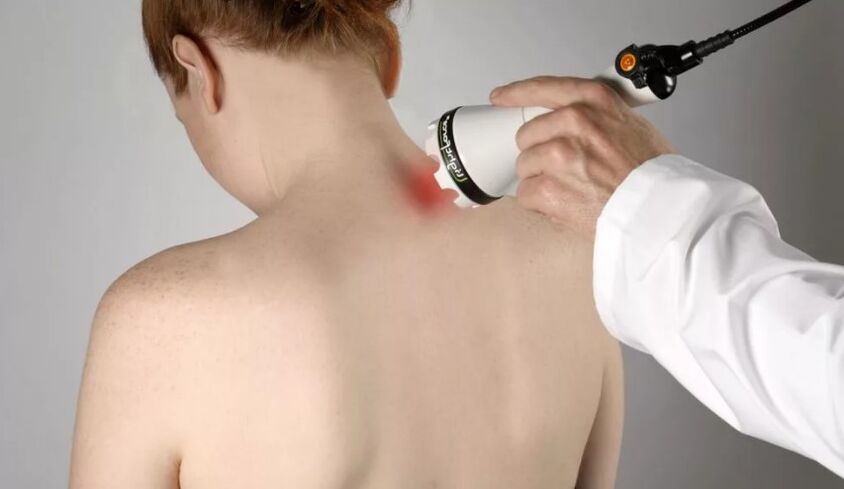 Physiotherapy method of the treatment of cervical osteochondosis