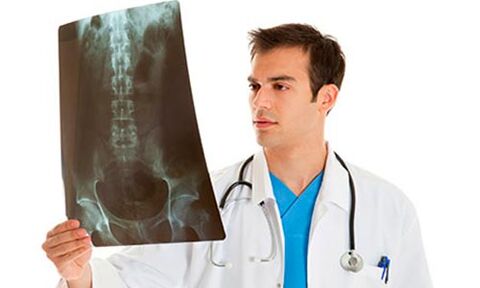 doctor examining x-rays to diagnose low back pain